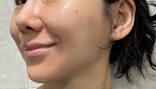 프리 (블로그체험단) [밀리밀리] 메디 앰플 콜라 15ml — 5점을 준 리뷰어가 2025년 7월 올린 사용 사진