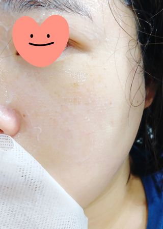 더메디코템 일루미네이팅 오로라 에멀젼마스크 — 5점을 준 리뷰어가 2025년 6월 올린 사용 사진
