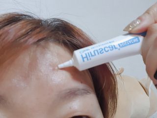 히루스카 포스트아크네 클리어 — 5점을 준 리뷰어가 2021년 1월 올린 사용 사진