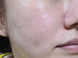 아이앤립 / EYENLIP 아이앤립 연어오일 리바이탈라이징 크림 — 3점을 준 리뷰어가 2021년 4월 올린 사용 사진