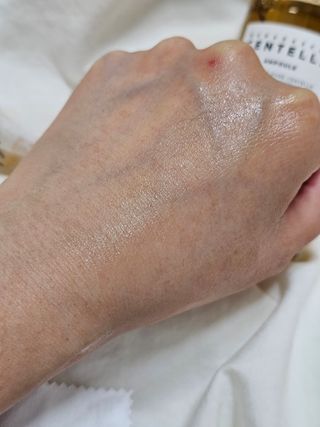 [스킨1004] 마다가스카르 센텔라 앰플 100ml — 5점을 준 리뷰어가 2024년 5월 올린 사용 사진