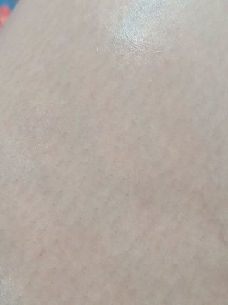[후르디아] 등드름 잡는 바디 미스트 2개 세트 — 4점을 준 리뷰어가 2021년 5월 올린 사용 사진