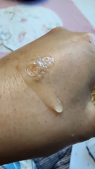 [스킨1004] 마다가스카르 센텔라 앰플 100ml — 5점을 준 리뷰어가 2024년 5월 올린 사용 사진