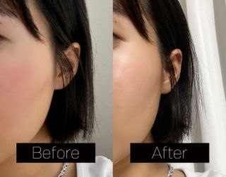 [스킨1004] 마다가스카르 센텔라 앰플 100ml — 5점을 준 리뷰어가 2024년 6월 올린 사용 사진