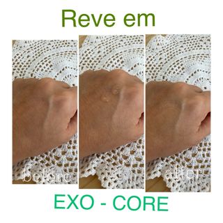 나우 [리브엠] 화해 1등 진정 앰플, 엑소코어 카밍 텐션 앰플 — 5점을 준 리뷰어가 2024년 11월 올린 사용 사진