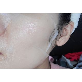 에이스노 레스큐 이미디에이트 수딩 시트마스크 — 5점을 준 리뷰어가 2021년 11월 올린 사용 사진