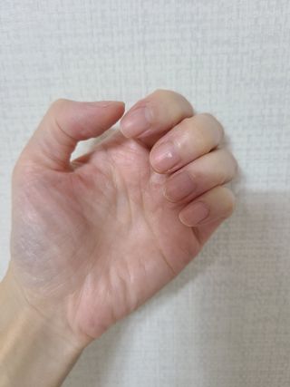 유케어 YOU CARE 문제성 손발톱케어_럭키풋 — 4점을 준 리뷰어가 2022년 10월 올린 사용 사진
