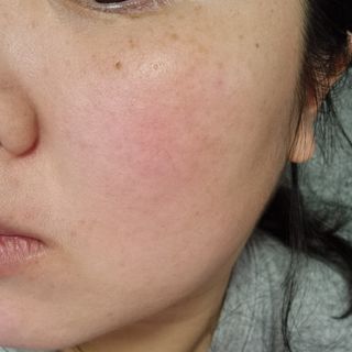 레드투래드 센서티브 어메이징 앰플 30ml — 5점을 준 리뷰어가 2021년 11월 올린 사용 사진