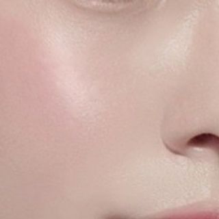 바이오오일 [바이오-오일] 드라이 스킨 젤 100ml — 5점을 준 리뷰어가 2021년 10월 올린 사용 사진