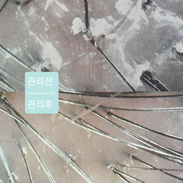 [모클락 강남본점] 쿨링 스케일링 이용권 리뷰 사진