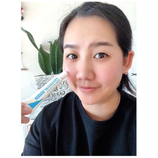 히루스카 포스트아크네 클리어 — 5점을 준 리뷰어가 2021년 1월 올린 사용 사진