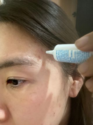 히루스카 포스트아크네 클리어 — 5점을 준 리뷰어가 2021년 1월 올린 사용 사진