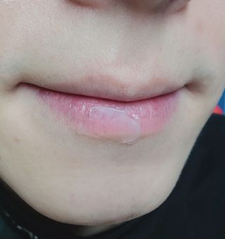 틱톡 [후르디아] 튼입술해결템 올리브영 블루베리 하이드레이팅 허니 립밤 — 5점을 준 리뷰어가 2023년 12월 올린 사용 사진