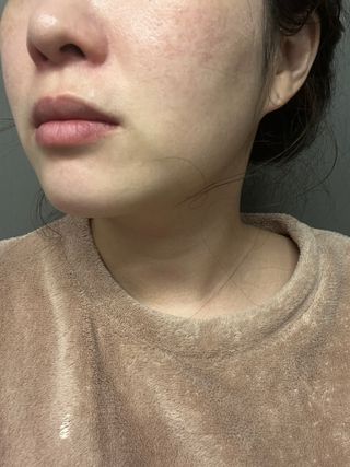 세뚜아(Cettua) [세뚜아] 포레스트 수딩 마스크 Cettual Forest  Soothing Mask 5매 — 5점을 준 리뷰어가 2024년 1월 올린 사용 사진