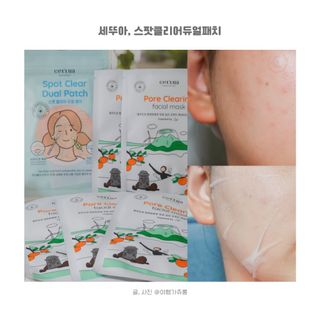 세뚜아(Cettua) 세뚜아 스팟 클리어 듀얼 패치 Cettua Spot Clear Dual Patch — 3점을 준 리뷰어가 2023년 9월 올린 사용 사진