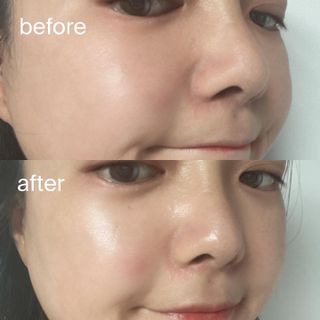 베지톨로지 비니페린 워터 에센스 — 5점을 준 리뷰어가 2022년 8월 올린 사용 사진