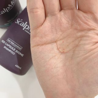 스칼프메드 레드캡슐바이옴 두피케어 프로바이오틱스 유산균 두피관리 세트 — 5점을 준 리뷰어가 2021년 4월 올린 사용 사진