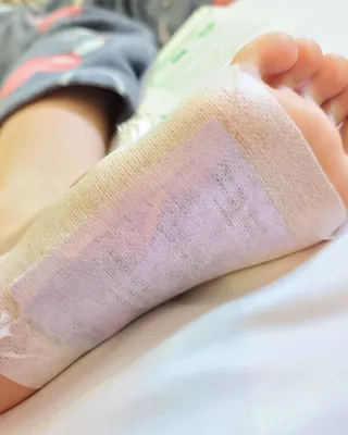 [레제르] 아로마 수액패치 발패치 30매입 -라벤더향/유칼립투스향/대나무향 — 5점을 준 리뷰어가 2022년 4월 올린 사용 사진