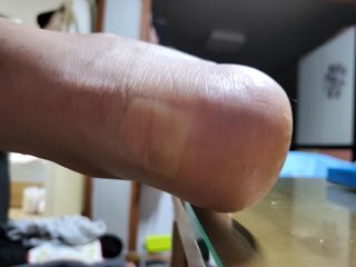 [큐어반H 커팅] 간편하게 떼서 쓰는 자외선차단 습윤밴드 (1팩/30매입) — 5점을 준 리뷰어가 2022년 12월 올린 사용 사진