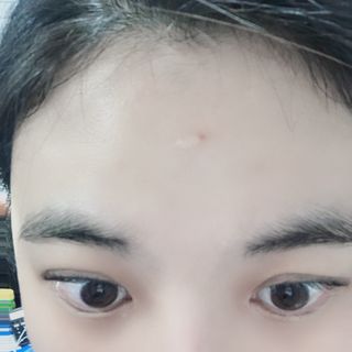히루스카 포스트아크네 클리어 — 5점을 준 리뷰어가 2021년 2월 올린 사용 사진