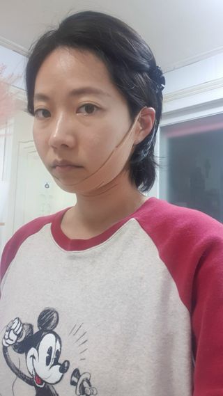 아이디플라코스메틱 아이디 페이스핏 마이너스 밴드 v2 — 4점을 준 리뷰어가 2021년 5월 올린 사용 사진
