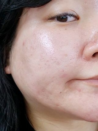 MF[스킨1004] 마다가스카르 센텔라 히알루-시카 워터핏 선세럼 50ml — 5점을 준 리뷰어가 2024년 5월 올린 사용 사진