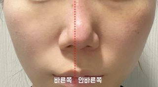 트리마이 바른 듯 안 바른듯 깨끗한 커버려 BB크림 — 4.5점을 준 리뷰어가 2023년 5월 올린 사용 사진