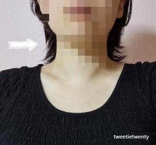 블랙몬스터 다운펌 프로 키트 — 4점을 준 리뷰어가 2021년 8월 올린 사용 사진