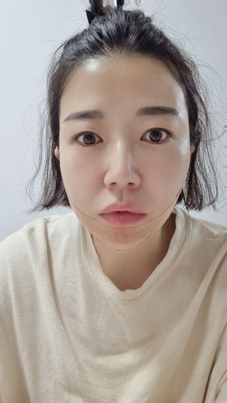 아이디플라코스메틱 아이디 페이스핏 마이너스 밴드 v2 — 4.5점을 준 리뷰어가 2022년 5월 올린 사용 사진