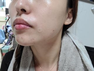 [큐어반H 스팟] 자외선 99프로 차단되는 스틱타입 스팟밴드(1팩 / 66매입) — 5점을 준 리뷰어가 2022년 11월 올린 사용 사진