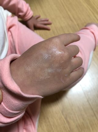 알레바 내츄럴 데일리 수딩 모이스처라이저럴 아기 로션 — 5점을 준 리뷰어가 2021년 2월 올린 사용 사진