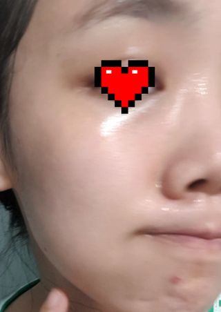 닥터마시멜로 닥터마스멜로 마블러스 아쿠아 클리닉 마스크 — 4점을 준 리뷰어가 2021년 7월 올린 사용 사진