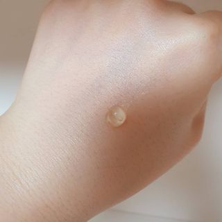 히루스카 포스트아크네 클리어 — 5점을 준 리뷰어가 2021년 2월 올린 사용 사진