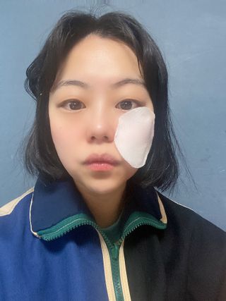 메디필 레드 락토 콜라겐 필링패드 — 4.5점을 준 리뷰어가 2021년 3월 올린 사용 사진