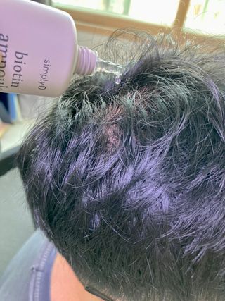 심플리오 비오틴 탈모케어 솔루션 2종 샴푸 500ml + 앰플 1개입 — 5점을 준 리뷰어가 2022년 4월 올린 사용 사진