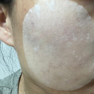랑벨 랑바이오 블랙 시카 퀵 패드 100매 (3초 쿨링/3분 흡수, 블랙비 프로폴리스/시카 4종 함유, 대용량) — 5점을 준 리뷰어가 2022년 5월 올린 사용 사진