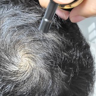 썸헤어 / SUMHAIR 썸헤어 써밋 안티 헤어로스 토닉 — 5점을 준 리뷰어가 2021년 5월 올린 사용 사진