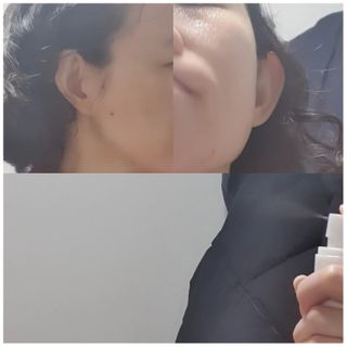 셀바이져 지우개 미스트 피부 보호 입주변 트러블 진정 케어 아기 안개분사 미스트 — 5점을 준 리뷰어가 2021년 3월 올린 사용 사진