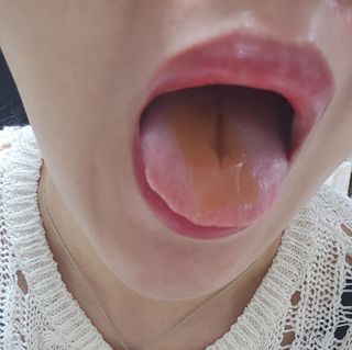 유나님이 올린 리뷰 사진 1