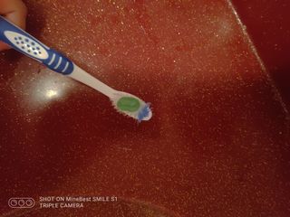프리마인 유해균 뿐만 아니라 유익균까지 씻어내는 치약은 그만, 건강한 구강환경을 만드는 덴탈엔오 — 4점을 준 리뷰어가 2022년 12월 올린 사용 사진