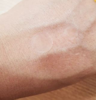 소담스퀘어 상암 디팩코퍼레이션 놀라아워 비건 하이드로콜로이드 클리어 패치 — 5점을 준 리뷰어가 2023년 1월 올린 사용 사진