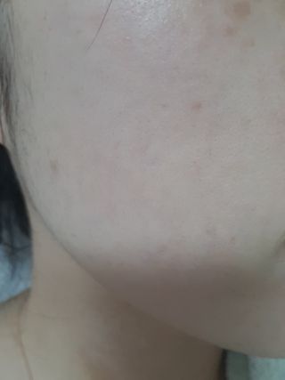 아이디플라코스메틱 페이스핏 플라스터 마스크 _ 리뉴얼 — 5점을 준 리뷰어가 2021년 4월 올린 사용 사진