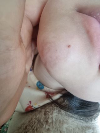 [큐어반H 스팟] 자외선 99프로 차단되는 스틱타입 스팟밴드(1팩 / 66매입) — 5점을 준 리뷰어가 2022년 11월 올린 사용 사진