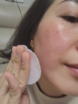 오투에니원 화이트 스완 갈락토미세스 비타민 C 필링 패드 60매 — 5점을 준 리뷰어가 2022년 12월 올린 사용 사진