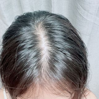 닥터시드 페퍼민트 앤 레몬 비건 비듬케어 쿨 탈모 두피 스크럽 샴푸 — 5점을 준 리뷰어가 2024년 7월 올린 사용 사진