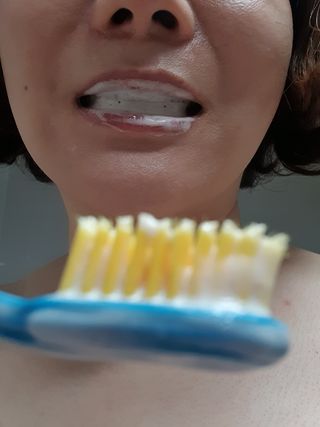 닥터데디스  잇몸치약 100g  [건강한 잇몸 관리를 위한 치약] + 여행용미니치약 15g — 5점을 준 리뷰어가 2022년 8월 올린 사용 사진