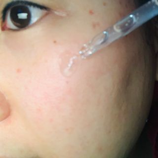 파시랩 시카 AC 솔루션 앰플 — 5점을 준 리뷰어가 2021년 8월 올린 사용 사진