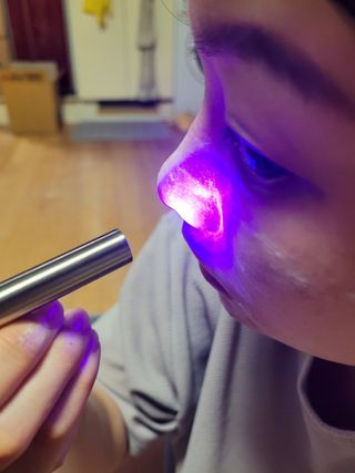 메데스 비츠케어 모공케어 피부관리키트 — 5점을 준 리뷰어가 2021년 6월 올린 사용 사진