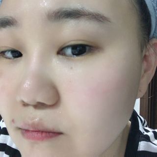 셀바이져 지우개 미스트 피부 보호 입주변 트러블 진정 케어 아기 안개분사 미스트 — 5점을 준 리뷰어가 2021년 1월 올린 사용 사진