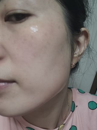 체르엠 스템앤셀 비타민 브라이트닝 에센스 30ml 1개 — 5점을 준 리뷰어가 2021년 9월 올린 사용 사진